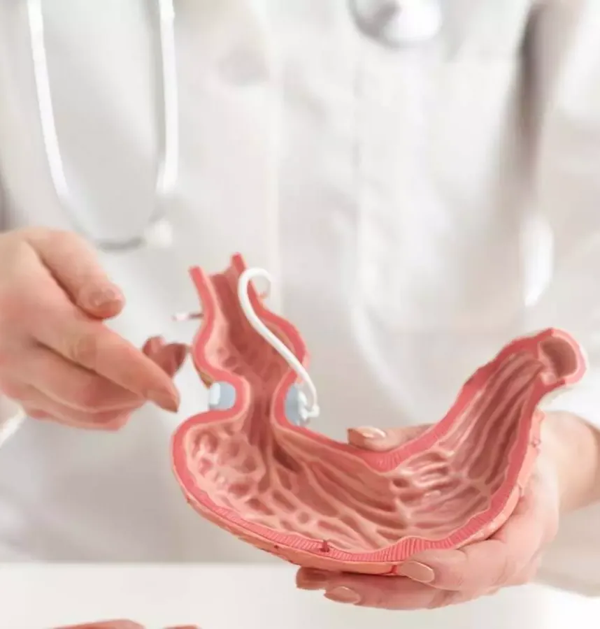 بای پس کلاسیک معده 