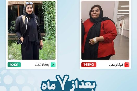 عکس قبل و بعد از عمل بای پس معده بیمار دکتر کیانی