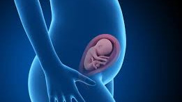 سردرد در بارداری: 